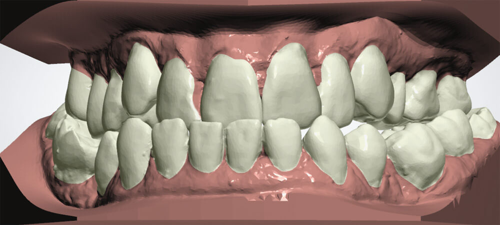 Schiene-5