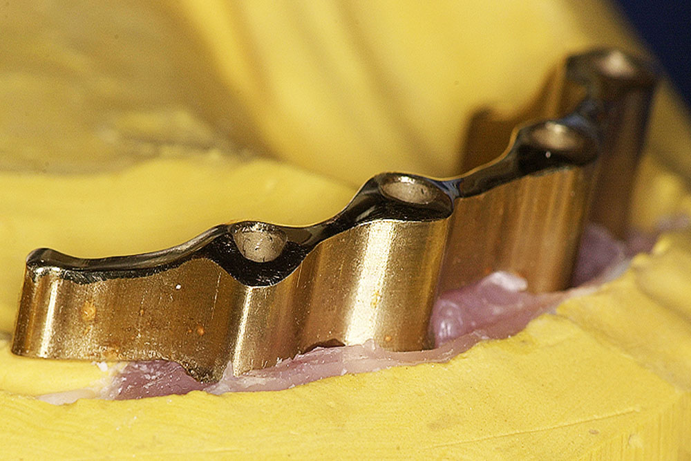 vz-goldgeruest-1