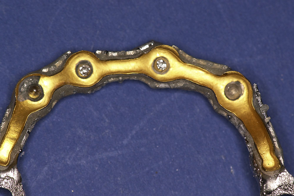 vz-goldgeruest-2